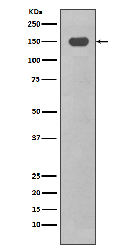 Western blot analysis of CD11c expression in THP-1 cell lysate treated with TPA