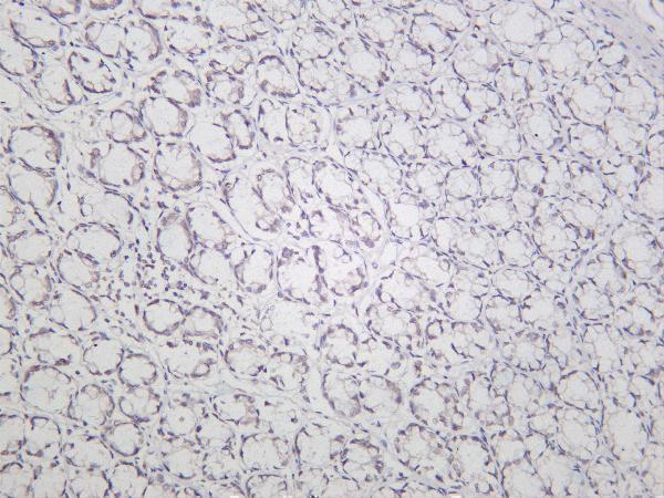 Rat colon tonsil was stained with Anti-CDK6 rabbit antibody
