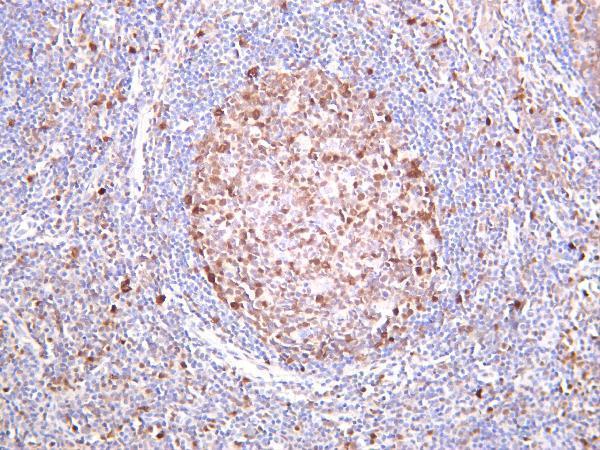 Human tonsil was stained with Anti-CDK6 rabbit antibody