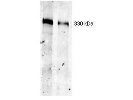 Western blot using Boster Immunochemical's Mouse Mab-anti-Thyroglobulin antibody