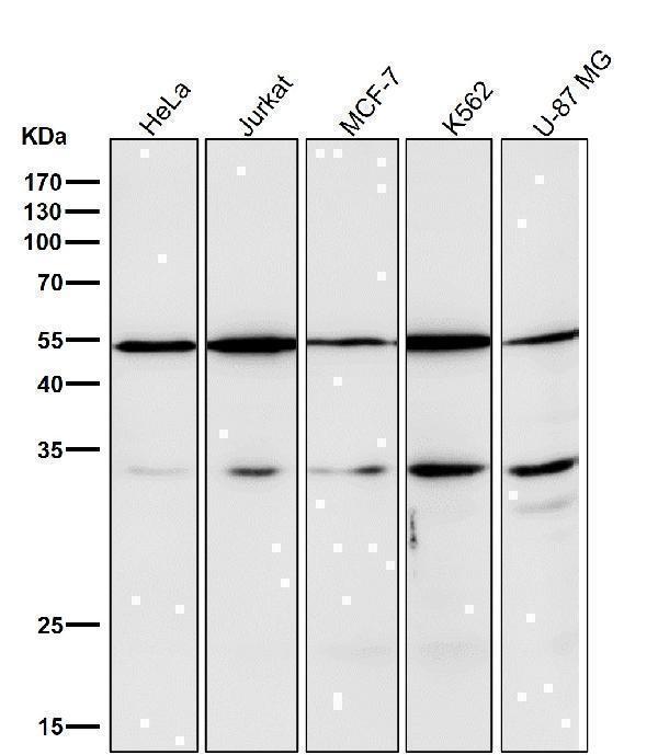 All lanes use the Antibody at 1:1K dilution for 1 hour at room temperature