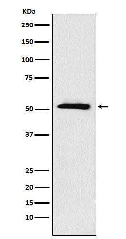 Western blot analysis of ETV6 expression in A431 cell lysate