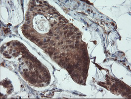 m00362 1 anti tms1 pycard mouse monoclonal antibody clone id oti3e9 ihc testing 4