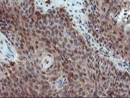 m00362 1 anti tms1 pycard mouse monoclonal antibody clone id oti3e9 ihc testing 5