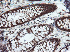 m00362 1 anti tms1 pycard mouse monoclonal antibody clone id oti3e9 ihc testing 6