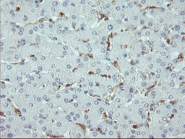 m00362 1 anti tms1 pycard mouse monoclonal antibody clone id oti3e9 ihc testing 7