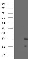 HEK293T cells were transfected with the pCMV6-ENTRY control (Left lane) or pCMV6-ENTRY PYCARD (Right lane) cDNA for 48 hrs and lysed