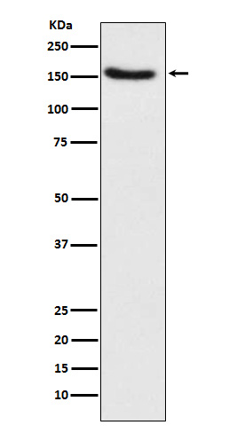 Western blot analysis of Hamartin expression in HeLa cell lysate