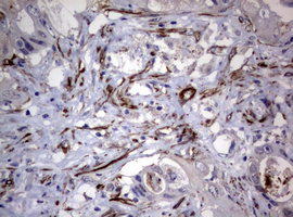 m00365 anti hamartin tsc1 mouse monoclonal antibody clone id oti3a2 ihc testing 10