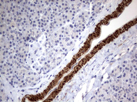 Immunohistochemical staining of paraffin-embedded Human pancreas tissue within the normal limits using anti-TSC1 mouse monoclonal antibody