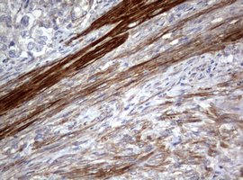 m00365 anti hamartin tsc1 mouse monoclonal antibody clone id oti3a2 ihc testing 4