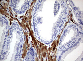 m00365 anti hamartin tsc1 mouse monoclonal antibody clone id oti3a2 ihc testing 5
