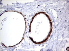 m00365 anti hamartin tsc1 mouse monoclonal antibody clone id oti3a2 ihc testing 6