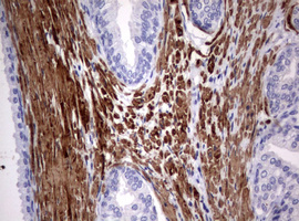 m00365 anti hamartin tsc1 mouse monoclonal antibody clone id oti3a2 ihc testing 7
