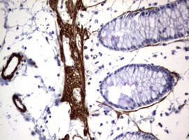 m00365 anti hamartin tsc1 mouse monoclonal antibody clone id oti3a2 ihc testing 9