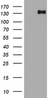 HEK293T cells were transfected with the pCMV6-ENTRY control (Left lane) or pCMV6-ENTRY TSC1 (Right lane) cDNA for 48 hrs and lysed