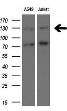 Western blot analysis of extracts (10ug) from 2 different cell lines by using anti-TSC1 monoclonal antibody at 1:200 dilution