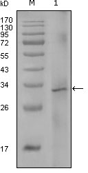 Western blotting validation for Anti-Factor VIII F8 Monoclonal Antibody M00367
Western Blot (WB) analysis using Factor VIII Monoclonal Antibody against truncated Trx-Factor VIII recombinant protein (1)
