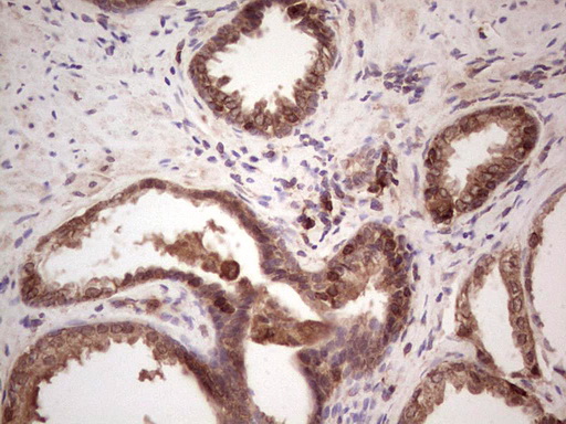 Immunohistochemical staining of paraffin-embedded Human prostate tissue within the normal limits using anti-ANGPT2 mouse monoclonal antibody
