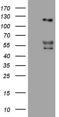 HEK293T cells were transfected with the pCMV6-ENTRY control (Left lane) or pCMV6-ENTRY ANGPT2 (Right lane) cDNA for 48 hrs and lysed