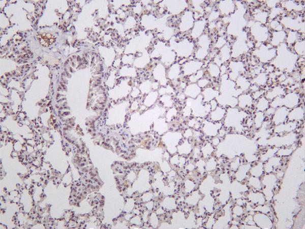 m00371 2 atf4 primary antibodies ihc testing 1
