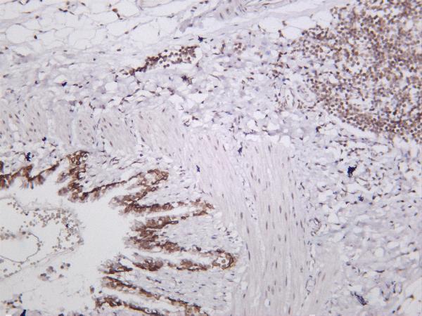 m00371 2 atf4 primary antibodies ihc testing 2