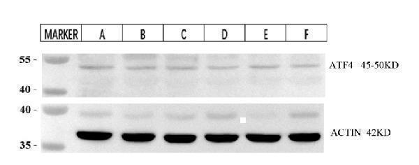m00371 atf4 primary antibodies wb testing 2