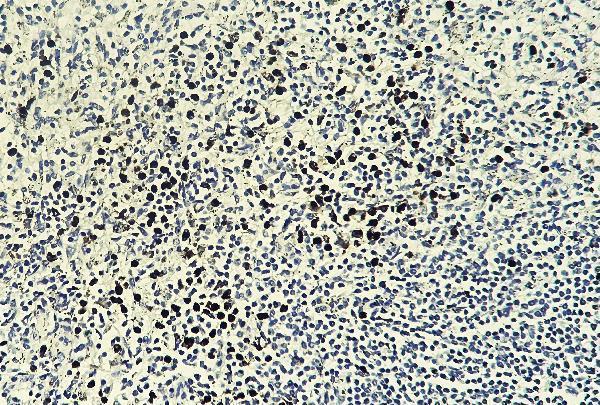 Human spleen tissue was stained with anti-Myeloperoxidase(MPO) rabbit Antibody