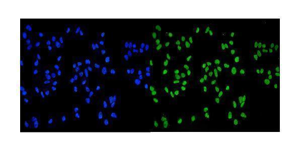 m00374 1 mcm2 primary antibodies if testing 5