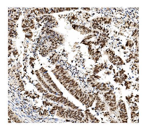 m00374 1 mcm2 primary antibodies ihc testing 3