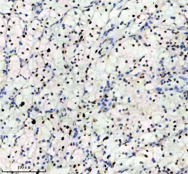 m00374 mcm2 primary antibodies ihc testing 10