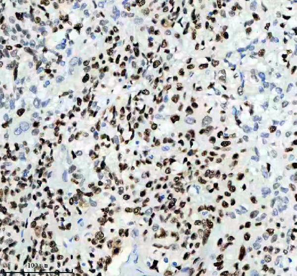 m00374 mcm2 primary antibodies ihc testing 11