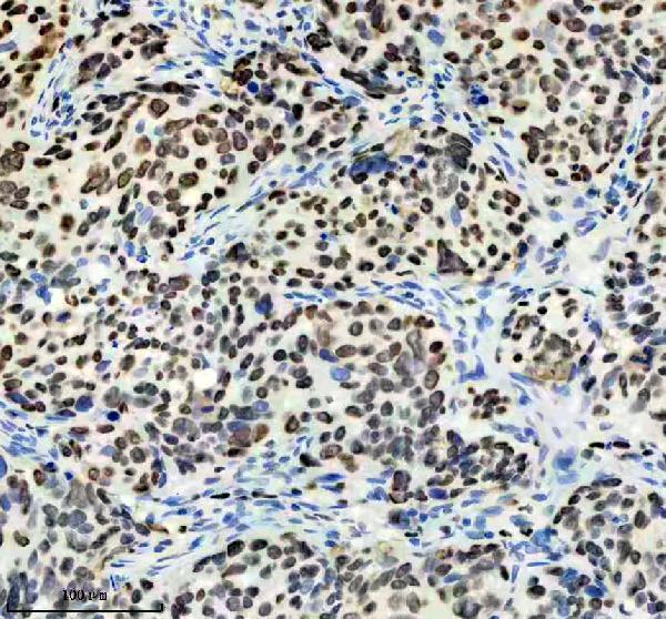 IHC analysis of MCM2 using anti-MCM2 antibody (M00374)