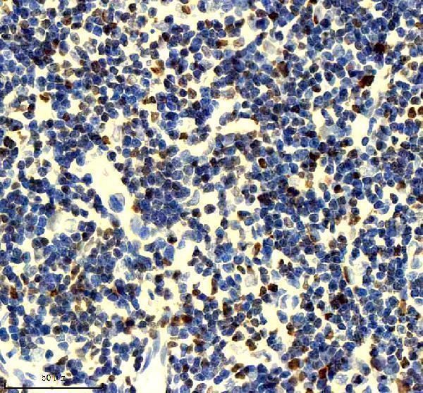 IHC analysis of MCM2 using anti-MCM2 antibody (M00374)