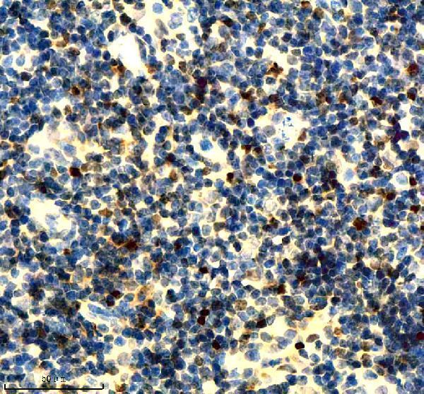 m00374 mcm2 primary antibodies ihc testing 14