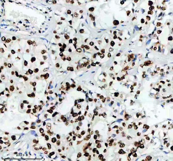 m00374 mcm2 primary antibodies ihc testing 3