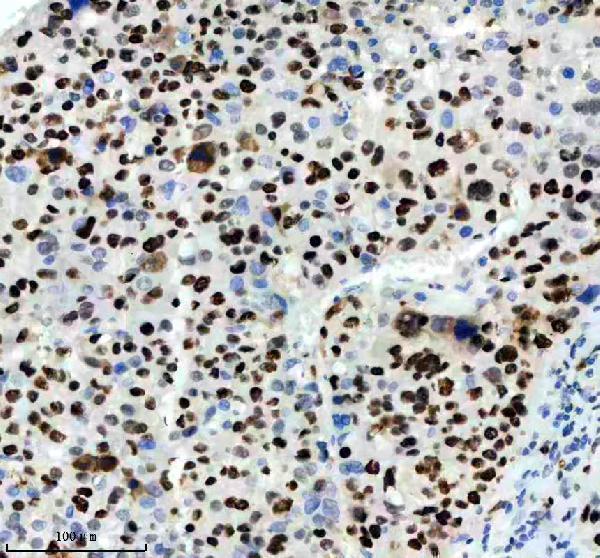 m00374 mcm2 primary antibodies ihc testing 4