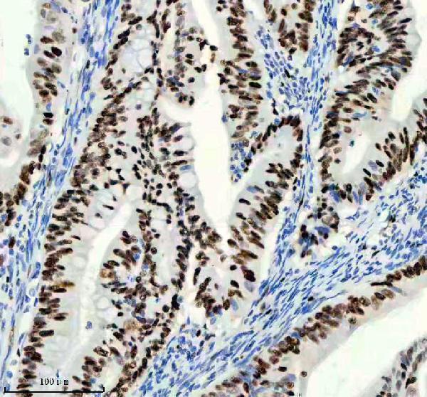 m00374 mcm2 primary antibodies ihc testing 5