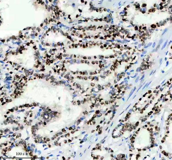 m00374 mcm2 primary antibodies ihc testing 6