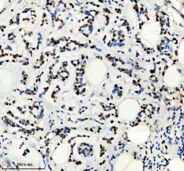 m00374 mcm2 primary antibodies ihc testing 7