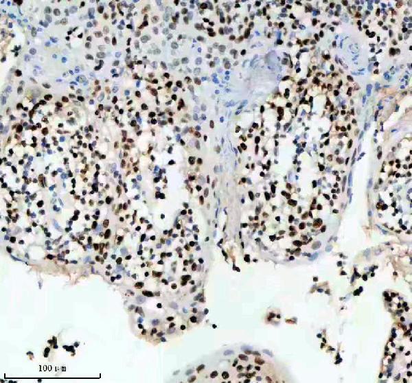 m00374 mcm2 primary antibodies ihc testing 9