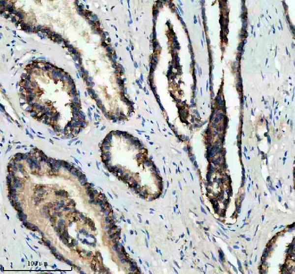 IHC analysis of CD46 using anti-CD46 antibody (M00377-1)