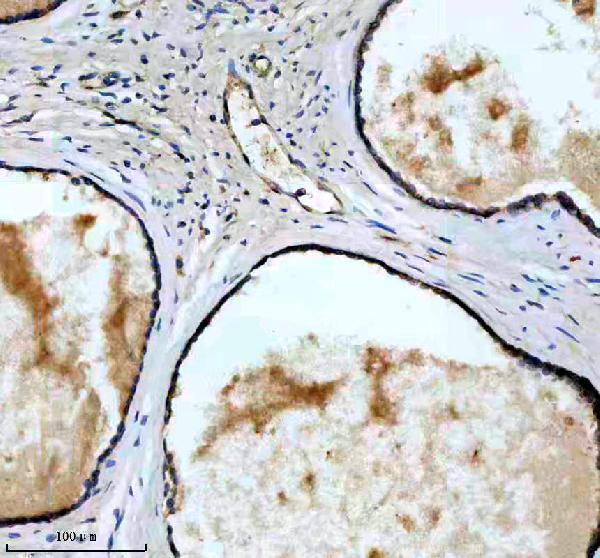 IHC analysis of CD46 using anti-CD46 antibody (M00377-1)