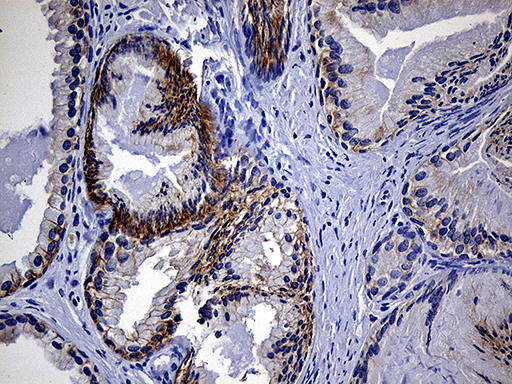 Immunohistochemical staining of paraffin-embedded Human prostate tissue within the normal limits using anti-EGF mouse monoclonal antibody