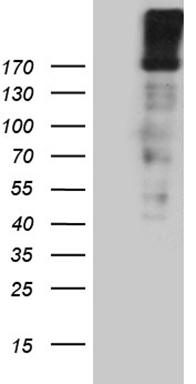 HEK293T cells were transfected with the pCMV6-ENTRY control (Left lane) or pCMV6-ENTRY EGF (Right lane) cDNA for 48 hrs and lysed