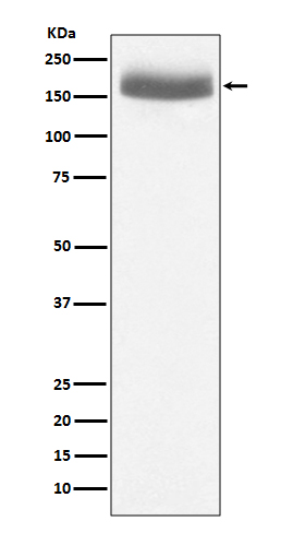 Western blot analysis of EGF expression in human urine sample lysate