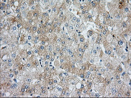 Immunohistochemical staining of paraffin-embedded Human liver tissue within the normal limits using anti-BIRC5 mouse monoclonal antibody. (Heat-induced epitope retrieval by 1mM EDTA in 10mM Tris
