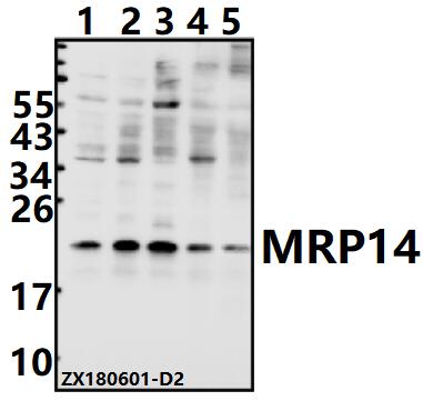 Western blot (WB) analysis of MRP14 (G3E10)  pAb at 1:500 dilution
Lane1:A375 whole cell lysate(40ug)
Lane2:EC9706 whole cell lysate(40ug)
Lane3:Myla2059 whole cell lysate(40ug)
Lane4:AML-12 whole cell lysate(40ug)
Lane5:PC12 whole cell lysate(40ug)