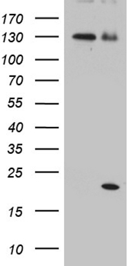 HEK293T cells were transfected with the pCMV6-ENTRY control (Left lane) or pCMV6-ENTRY IL2 (Right lane) cDNA for 48 hrs and lysed