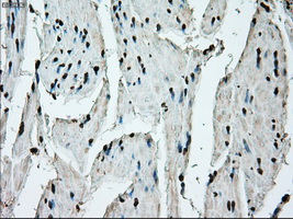 m00388 1 anti ercc1 mouse monoclonal antibody clone id oti1a3 ihc testing 11